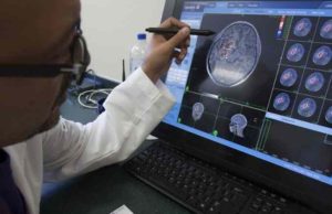 Cifras de cáncer se disparan en medio de la pandemia