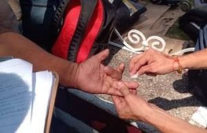 Detectan casos de Malaria en migrantes