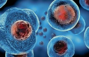 Mujer se cura de SIDA con trasplante de células madre; es la primera en lograrlo