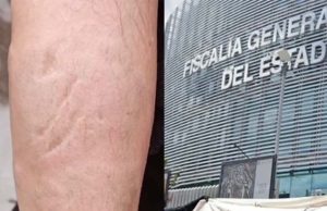 “Adiós guapa”, gritan a mujer mientras le lanzan ácido en Puebla