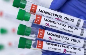 Argentina confirma caso de viruela del mono y detecta nuevo sospechoso