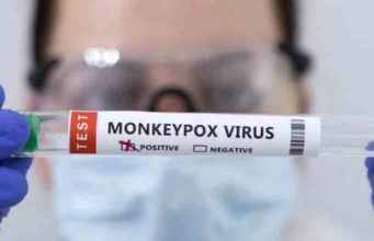 Reportan primer caso de viruela símica en Quintana Roo; paciente se encuentra estable y aislado