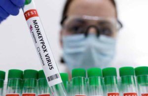 Edomex reporta primeros dos casos de viruela del mono