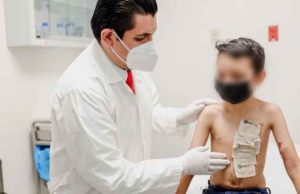 Chiapas: Con injerto de piel cultivada, IMSS ayuda a recuperación de pacientes quemados