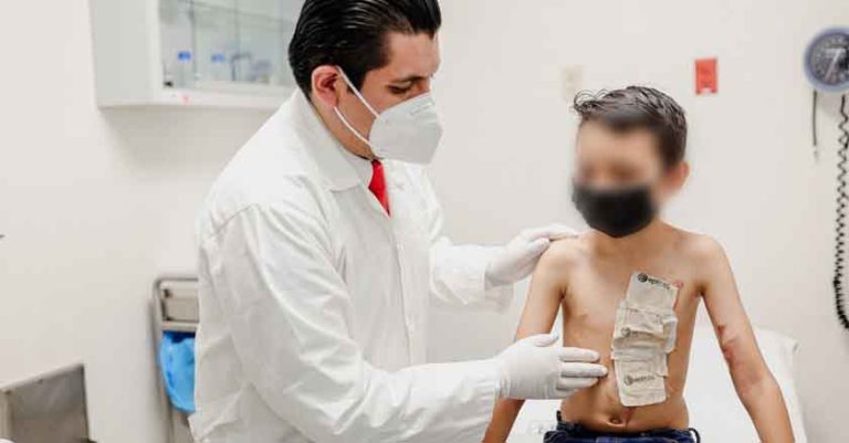 Chiapas: Con injerto de piel cultivada, IMSS ayuda a recuperación de pacientes quemados