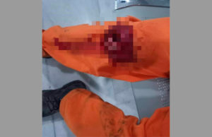 ¡San Cristóbal fuera de control!: Balacera deja dos personas heridas y decenas en crisis nerviosas